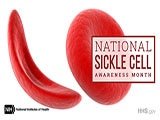 sickle cell and a healthy cell