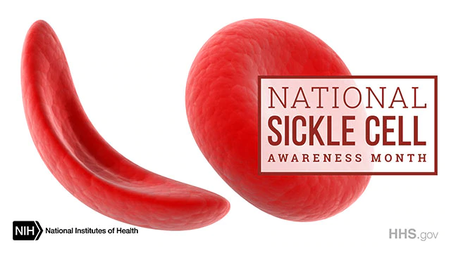 sickle cell and a healthy cell