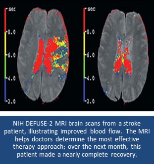 Brain scan image.