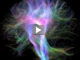Read a blog post about how tractography is helping us understanding how the human brain is wired.